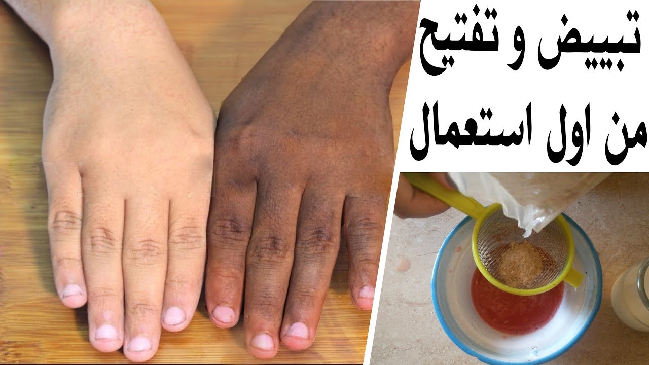 هتتخلصي من سواد واسمرار يديكِ.. وصفة منزلية ناجحة لتبييض اليدين والتخلص من أي بقع على بشرتك 5 هتتخلصي من سواد واسمرار يديكِ.. وصفة منزلية ناجحة لتبييض اليدين والتخلص من أي بقع على بشرتك