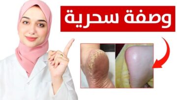كعبك هيبقي زي الحرير.. بملعقة خل وملح تخلصي من تشققات القدمين والجلد الميت والسواد المتراكم من اول استعمال