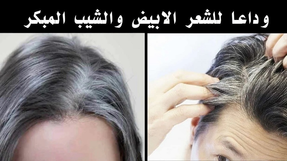 طريقة القضاء على الشعر الأبيض نهائيا وتغطية مثالية للشيب بدون صبغات ضارة لن يعود مجدداً 2 طريقة القضاء على الشعر الأبيض نهائيا وتغطية مثالية للشيب بدون صبغات ضارة لن يعود مجدداً
