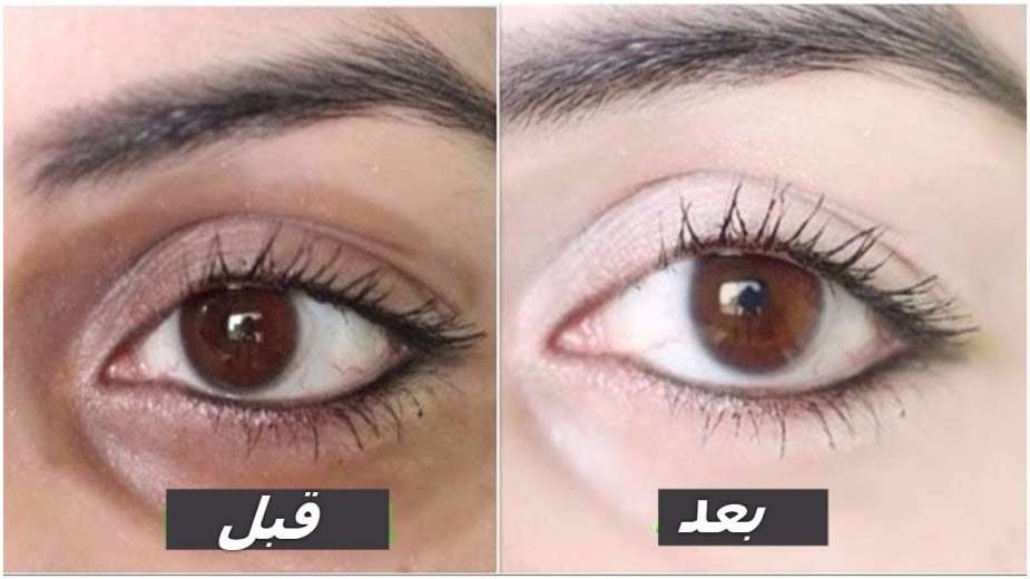 بمكونات طبيعية... اتخلصي من الهالات السوداء في أسرع وقت 5 بمكونات طبيعية… اتخلصي من الهالات السوداء في أسرع وقت