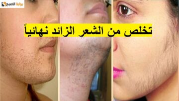 وداعاً للشعر الزائد نهائياً! وصفات طبيعية للتخلص من شعر الوجه والجسم