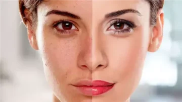 أضرار وضع كريم تفتيح البشرة بعد التعرض للشمس