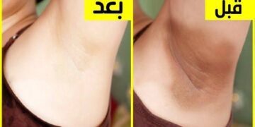 مقشر سحري طبيعي لتفتيح المناطق الداكنة والإبط في 3 أيام فقط