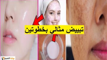 فاعلية سحرية في تفتيح البشرة وإزالة التصبغات والبقع بمكونات طبيعية متوفرة في منزلك