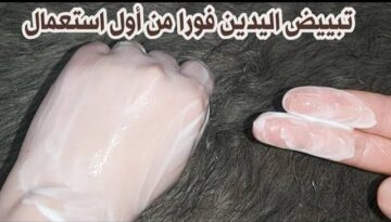 هتبقى شبه ايد الأميرات.. وصفة سحرية للتخلص من أسمرا اليدين من أول استخدام