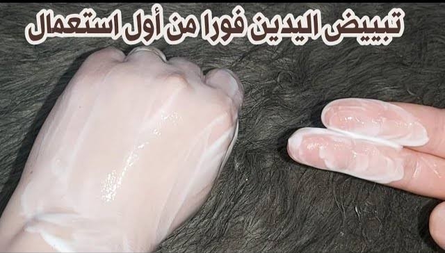 هتبقى شبه ايد الأميرات.. وصفة سحرية للتخلص من أسمرا اليدين من أول استخدام