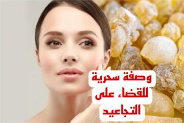 هترجعي 20 سنه لورا.. وصفة سحرية للقضاء على كافة التجاعيد وشد الجلد.. تعرفي عليها الان..!!