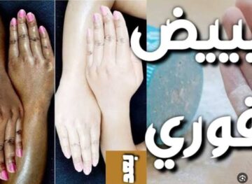 وصفة طبيعية لتفتيح اليدين وتوحيد اللون