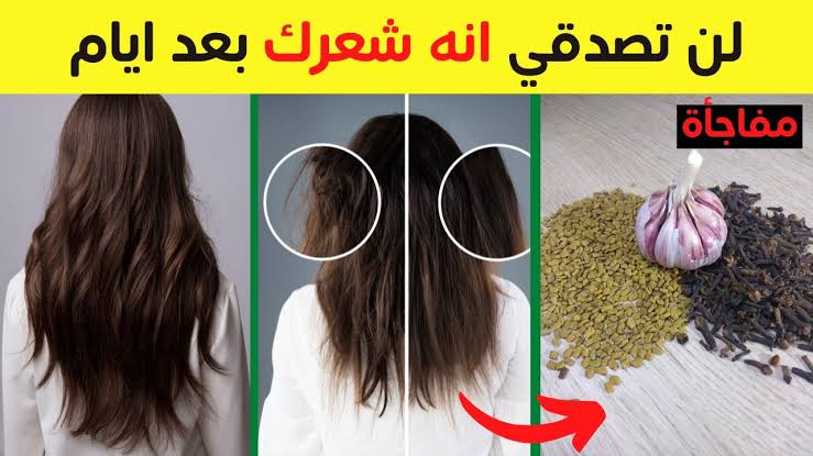 لو شعرك بيقع ماتشليش هم تاني.. وصفات طبيعية تساعد على حماية الشعر من التساقط 3 لو شعرك بيقع ماتشليش هم تاني.. وصفات طبيعية تساعد على حماية الشعر من التساقط