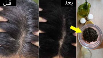 أفضل الطرق الطبيعية للقضاء على الشعر الأبيض من غير صبغات وفعالة بنسبة 100%