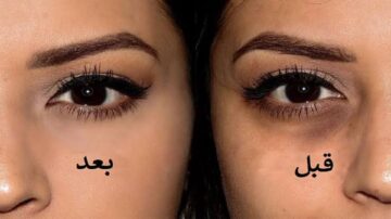 خلي عيونك ترجع تنور.. وصفة طبيعية لعلاج الهالات السوداء وإعادة بشرتك إلى رونقها