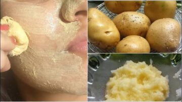 مش هتصدقي اللي هيحصلك.. ماسك البطاطس للبشرة اعمليه بالطريقة دي وشوفي جمالك هيبقى ازاي
