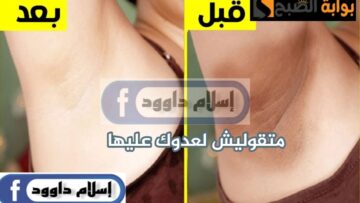 الوصفة السحرية.. طريقة تفتيح المناطق الحساسة بالنشا والليمون جربيها هتبهرك
