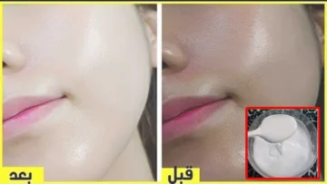 خلطة النشا لتبييض وتفتيح الوجه وإزالة البقع الداكنة