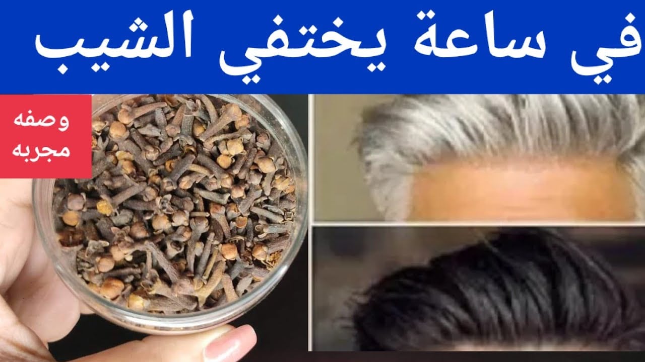 ودعي الشيب.. طريقة القرنفل للتخلص من الشعر الأبيض نهائيا بدون رجوعه مرة أخرى وبدون صبغات كيميائية ضارة 5 ودعي الشيب.. طريقة القرنفل للتخلص من الشعر الأبيض نهائيا بدون رجوعه مرة أخرى وبدون صبغات كيميائية ضارة