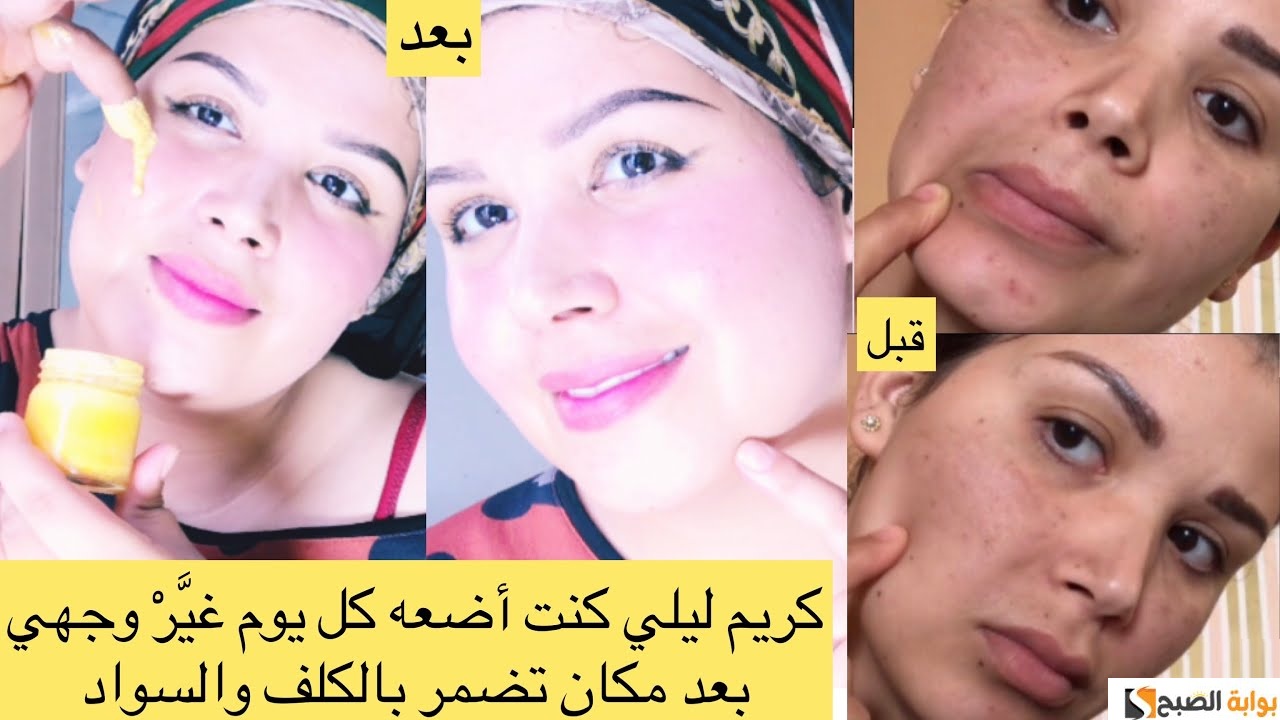 كريم ليلي للتخلص من تجاعيد البشرة والتصبغات