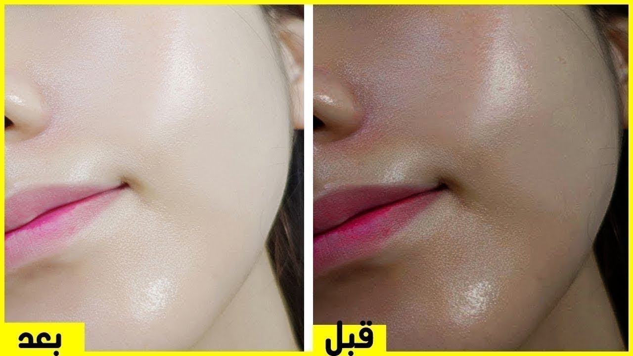 "استخدمي الوصفة السحرية وخلي أصحابك يغيروا منك" .. ب 3 مكونات بس هتخلي بشرتك زي بياض التلج وهتدعي لي 5 “استخدمي الوصفة السحرية وخلي أصحابك يغيروا منك” .. ب 3 مكونات بس هتخلي بشرتك زي بياض التلج وهتدعي لي