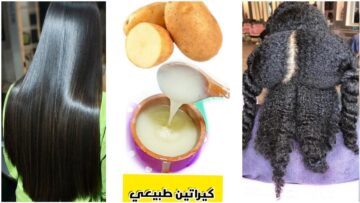 تعرفي على فوائد قشر البطاطس الرهيبه الاولى يا ريتني عرفتها من زمان