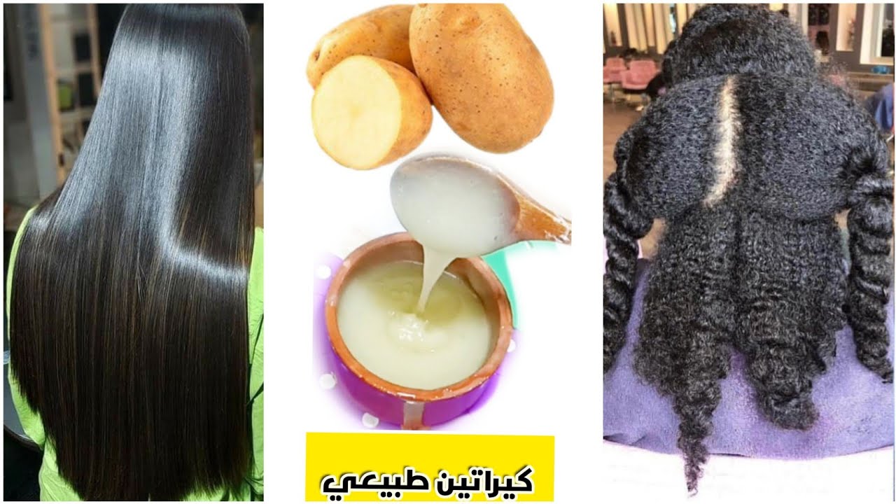 تعرفي على فوائد قشر البطاطس الرهيبه الاولى يا ريتني عرفتها من زمان 5 تعرفي على فوائد قشر البطاطس الرهيبه الاولى يا ريتني عرفتها من زمان