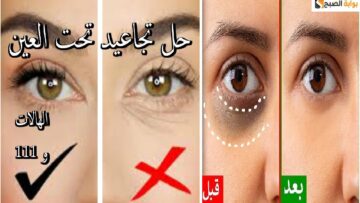 بمكونين فقط تخلصي من إسمرار وتجاعيد حول العينين بأسهل طريقة