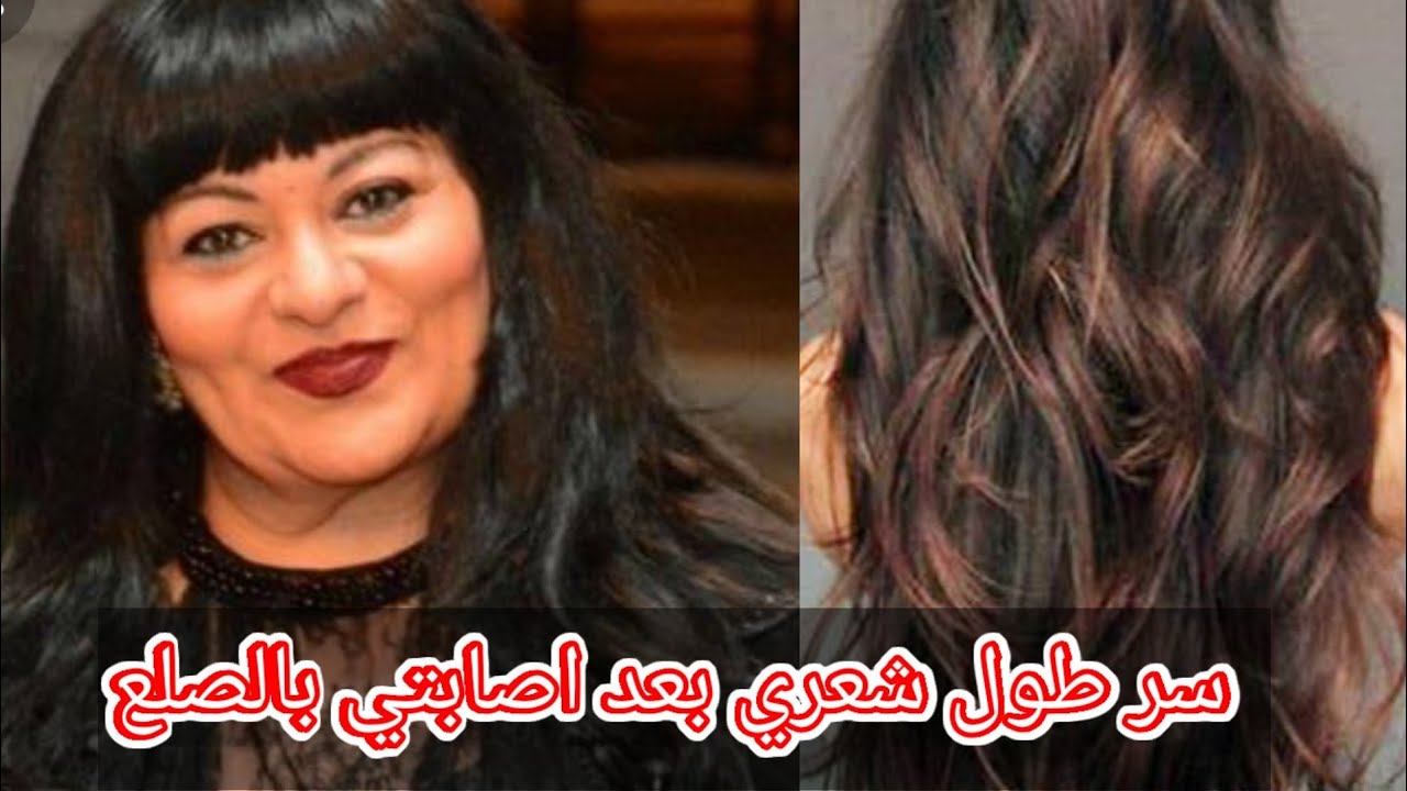 وصفه فريدة سيف النصر لانبات الشعر وتطويله ووقف التساقط لن تصدقي هيطول بسرعه الصاروخ 5 وصفه فريدة سيف النصر لانبات الشعر وتطويله ووقف التساقط لن تصدقي هيطول بسرعه الصاروخ