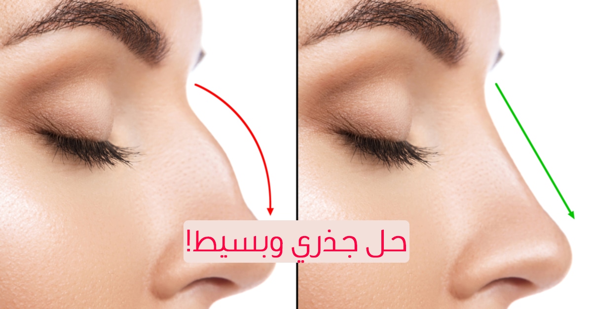 بدون جراحة.. طريقة فعالة للحصول على أنف صغير وجذاب 5 بدون جراحة.. طريقة فعالة للحصول على أنف صغير وجذاب