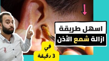 بدون دكتور وبدن ألم….أسهل طريقة لتنظيف الأذن من الشمع في البيت بكل سهوله وفي 3 دقائق بس