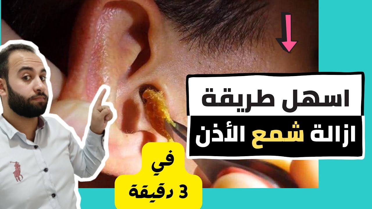 بدون دكتور وبدن ألم….أسهل طريقة لتنظيف الأذن من الشمع في البيت بكل سهوله وفي 3 دقائق بس