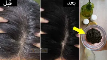طريقة لإزالة الشعر الأبيض .. بملعقة واحدة خالية من الصبغات والأضرار وداعا للطرق المعتادة