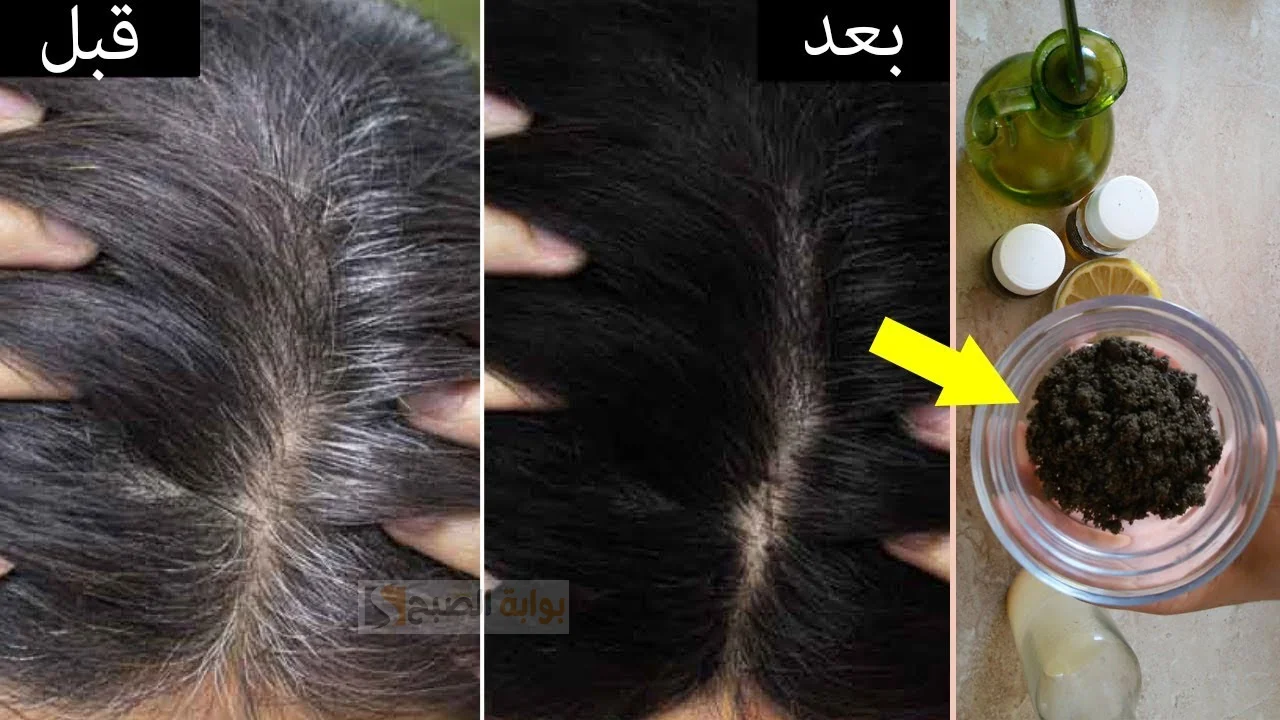 طريقة لإزالة الشعر الأبيض .. بملعقة واحدة خالية من الصبغات والأضرار وداعا للطرق المعتادة 5 طريقة لإزالة الشعر الأبيض .. بملعقة واحدة خالية من الصبغات والأضرار وداعا للطرق المعتادة
