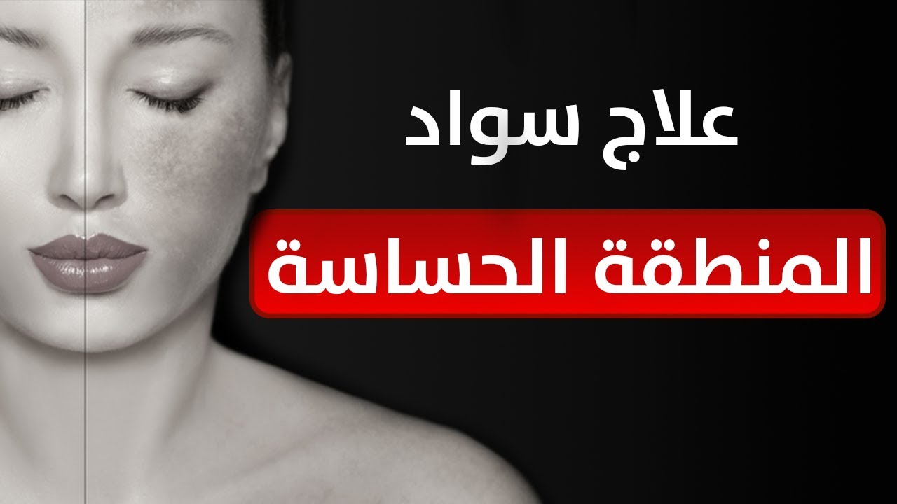 وداعًا اسمرار المناطق الحساسة بطرق طبيعية وآمنة والنتائج مرضية 5 وداعًا اسمرار المناطق الحساسة بطرق طبيعية وآمنة والنتائج مرضية