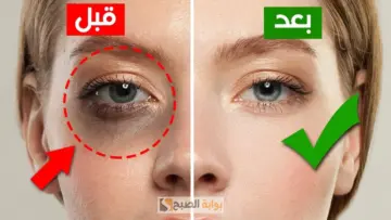 وداعا لعيون الباندا.. بمكونات منزلية تخلصي من الهالات السوداء أسفل العين.. «وشك هينور»