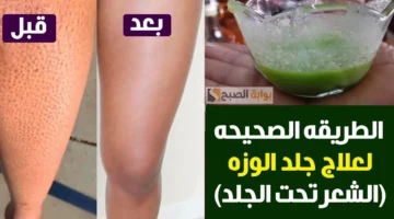 التخلص من جلد الوزة