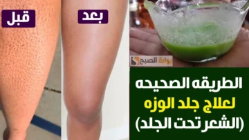 وصفات طبيعية هتقضى على مشكلة جلد الوزة وهتخلى بشرتك زى الحرير