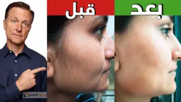 جمالك مش هيبقاله وصف.. وصفات طبيعية لتقليل نمو الشعر الزائد فى الوجه “هتبقى ناعمة”