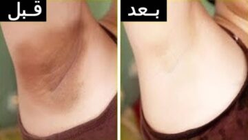 كيف ابيض المناطق الحساسة في اسبوع؟ .. وصفة لتفتيح المناطق الحساسة تعرفي علي التفاصيل