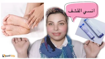 مكون منزلي للقضاء على القشف وتشققات القدمين في 20 دقيقة بس رجلك هتنور
