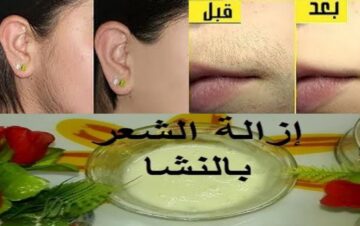 معجزة ملعقة النشا لإزالة شعر الوجه والجسم كله من الجذور وتبيض فوري للمناطق الغامقة من أول استعمال