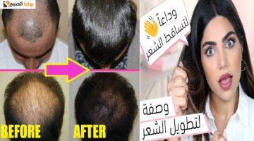 تجارب الثوم للشعر1