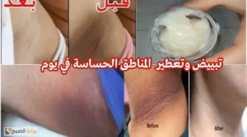 تفتيح الجسم وإزالة الاسمرار من المناطق الحساسة