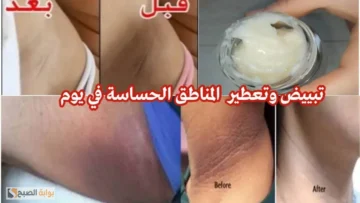 طريقة عمل دلكة الليمون مع الخل لتفتيح الجسم وإزالة الاسمرار من المناطق الحساسة “هتنوري زي الشمعة يوم زفافك”