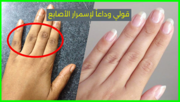 “أصابع بيضاء زي الثلج” وصفات سحرية طبيعية لتفتيح أصابعك بدون تكلفة عالية!