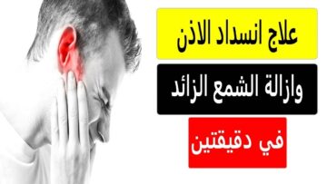 طريقة عبقرية لتنظيف الأذن من الشمع بكل سهولة وبدون الم في 3 دقائق مش هتحتاجي تروحي عند دكتور بعد اليوم
