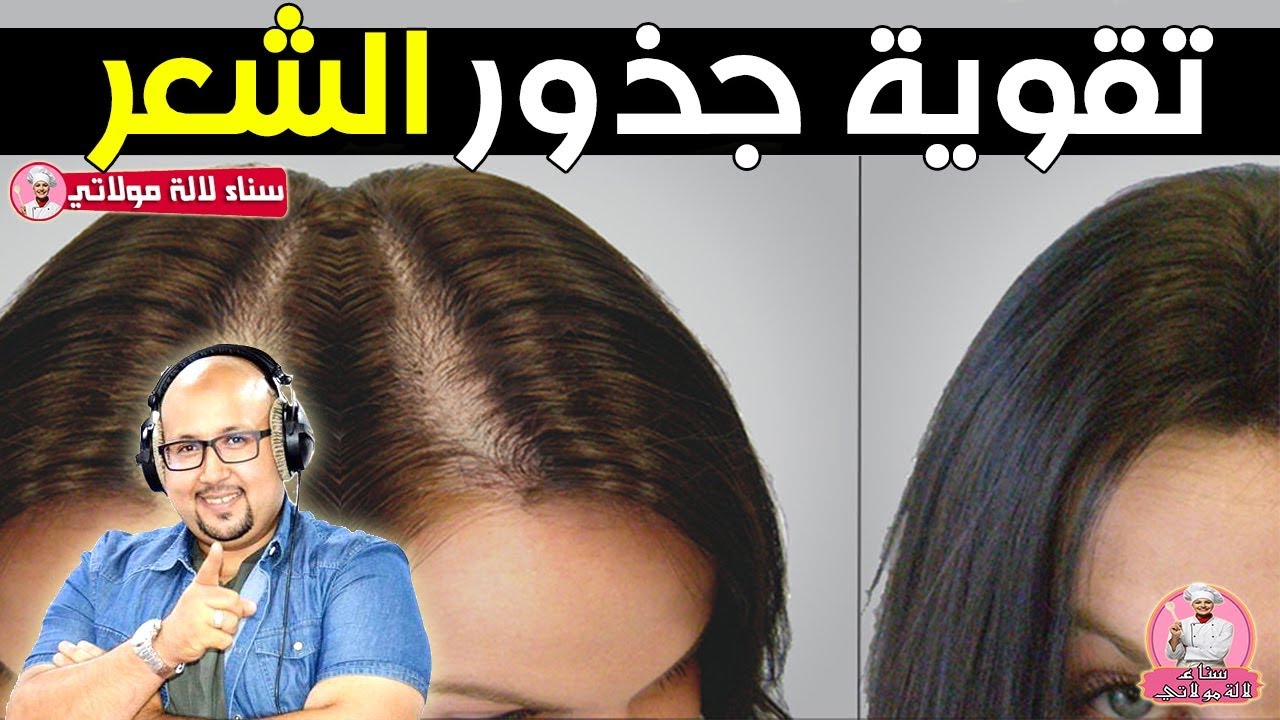 جربيها الآن.. 3 وصفات فعالة لعلاج ضعف جذور الشعر هتخلي شعرك قوي وبيلمع 5 جربيها الآن.. 3 وصفات فعالة لعلاج ضعف جذور الشعر هتخلي شعرك قوي وبيلمع
