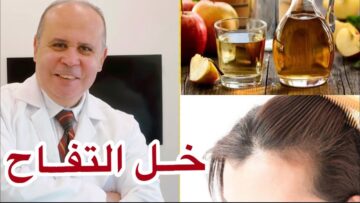 خل التفاح للشعر كنز طبيعي هيعالج ويقوي شعرك