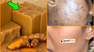 صابونة الكركم للبشرة