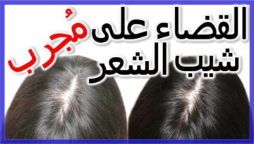 للشباب الدائم.. طريقة طبيعية للتخلص من الشيب وإعادة الشعر للونه الأصلي بدون صبغة
