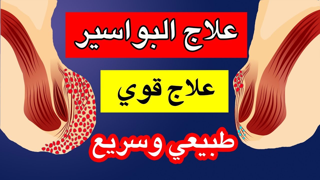 وصفة صينية شهيرة لعلاج البواسير الداخلية والخارجية نهائيا والنتيجة من أول استعمال 5 وصفة صينية شهيرة لعلاج البواسير الداخلية والخارجية نهائيا والنتيجة من أول استعمال
