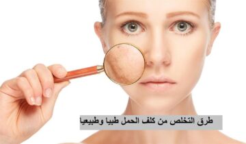 الطريق إلى بشرة خالية من كلف الحمل.. علاجات طبية وطبيعية