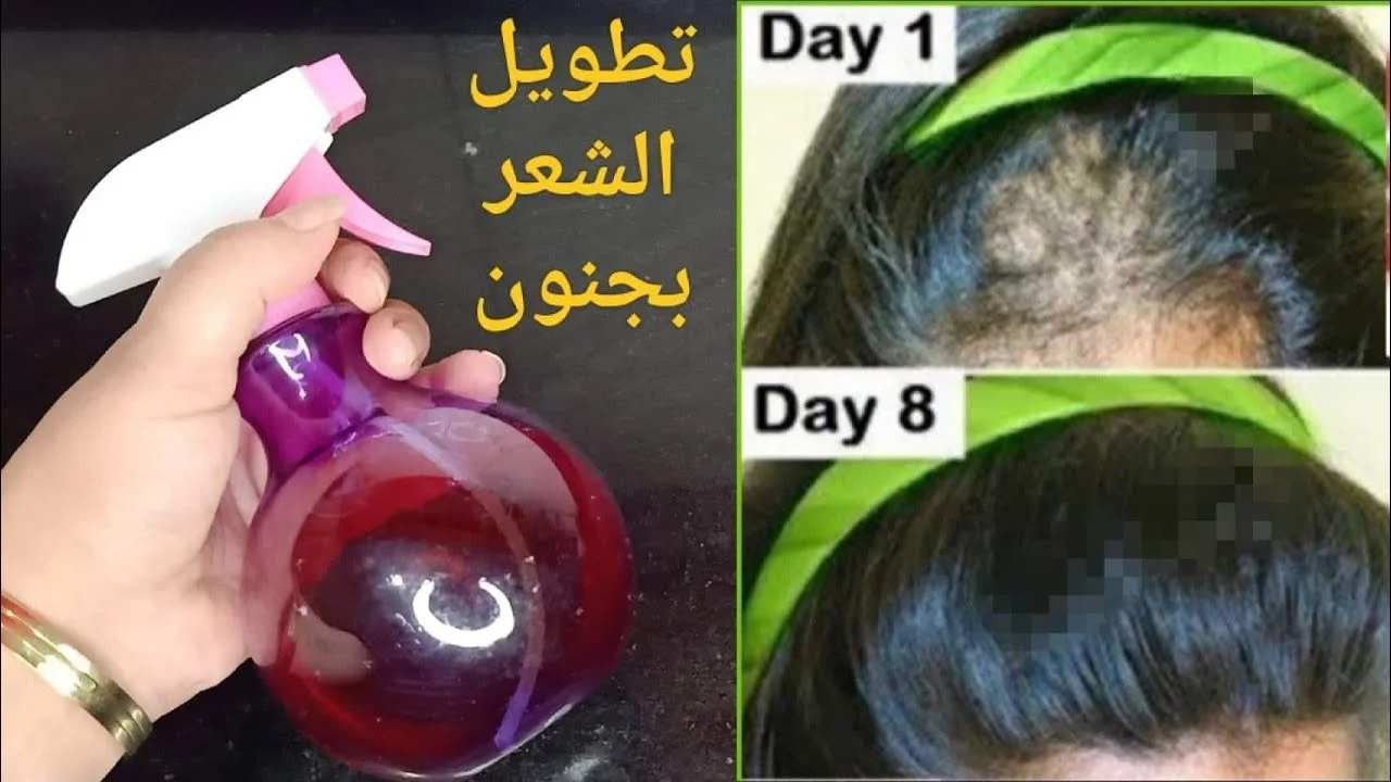 تعالي قبل العيد.. عشبة تطويل الشعر بسرعة مش هتصدقي النتيجة